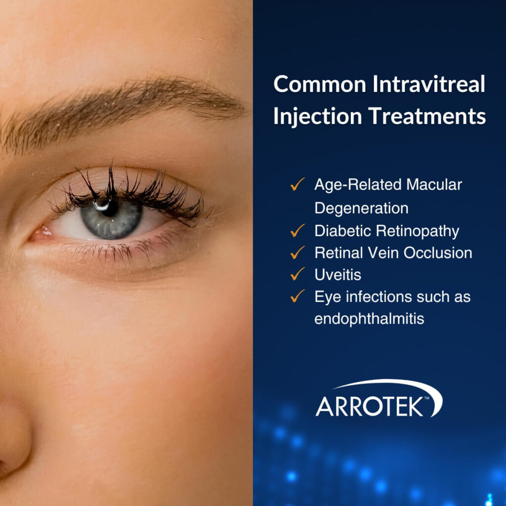 Common Intravitreal injection treatments